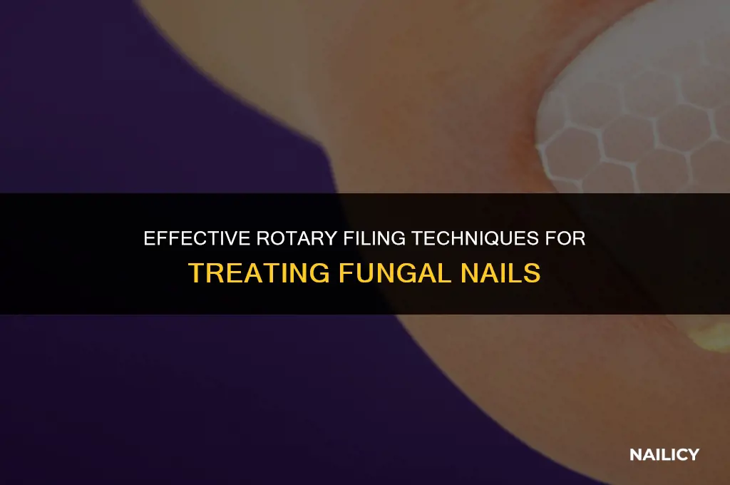 how to use a rotary file on fungal nails