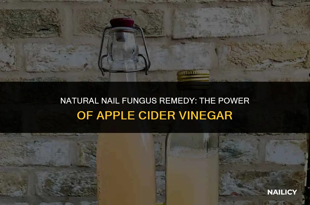 how to use acv for nail fungus