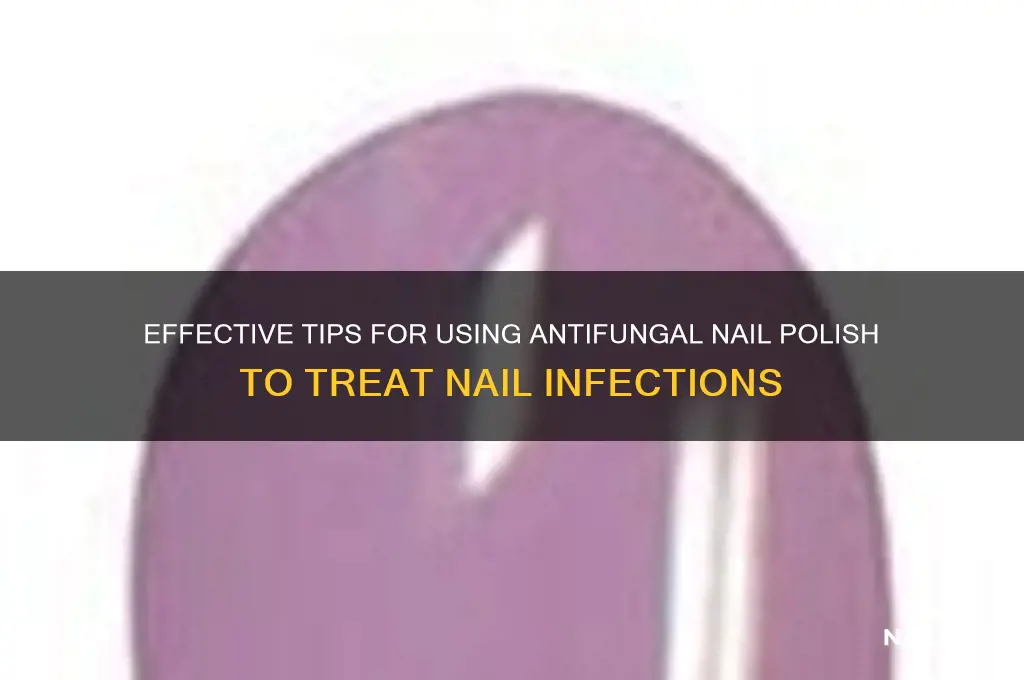 how to use antifungal nail polish