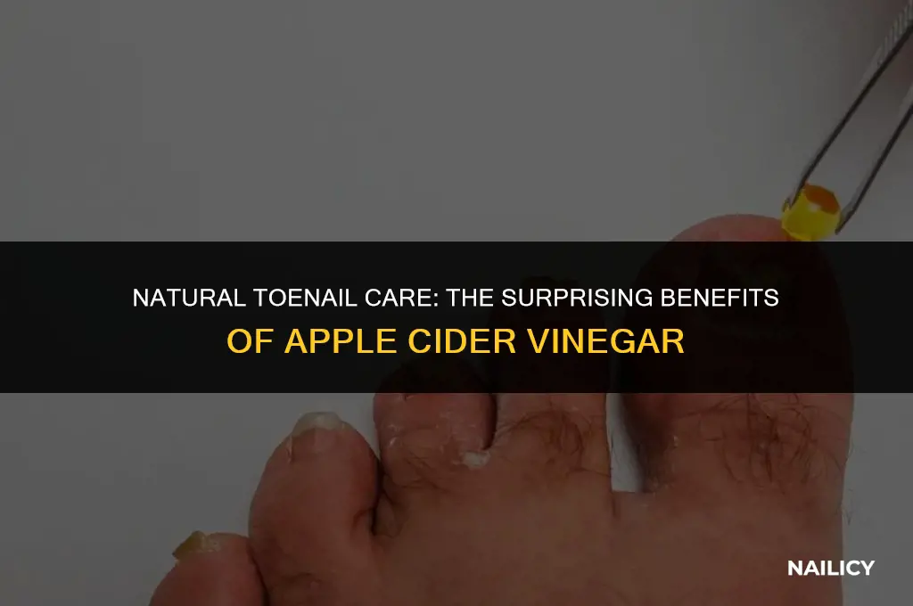 how to use apply cider vinegar for toe nail fun
