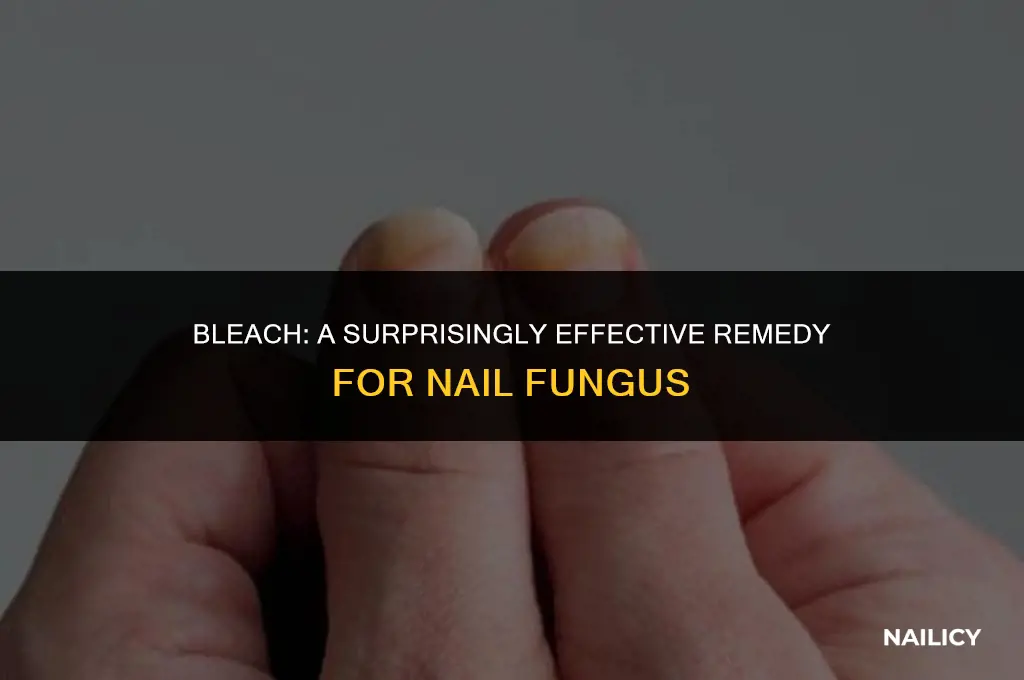 how to use bleach to cure nail fungus