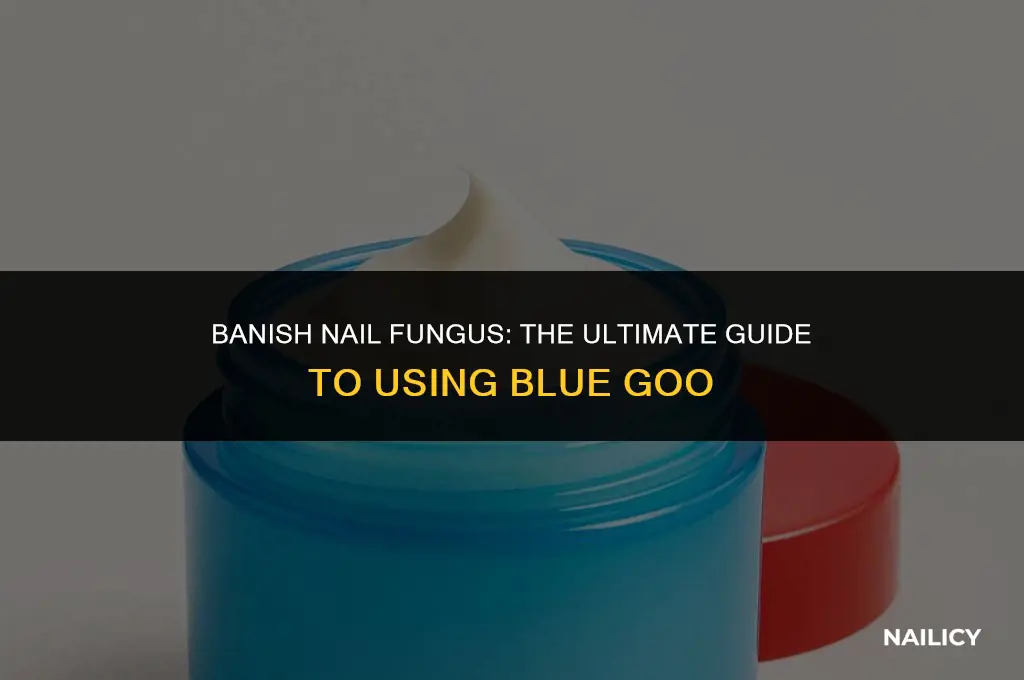 how to use blue goo nail fungus