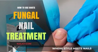 Effective Steps for Treating Fungal Nails with Boots Medication