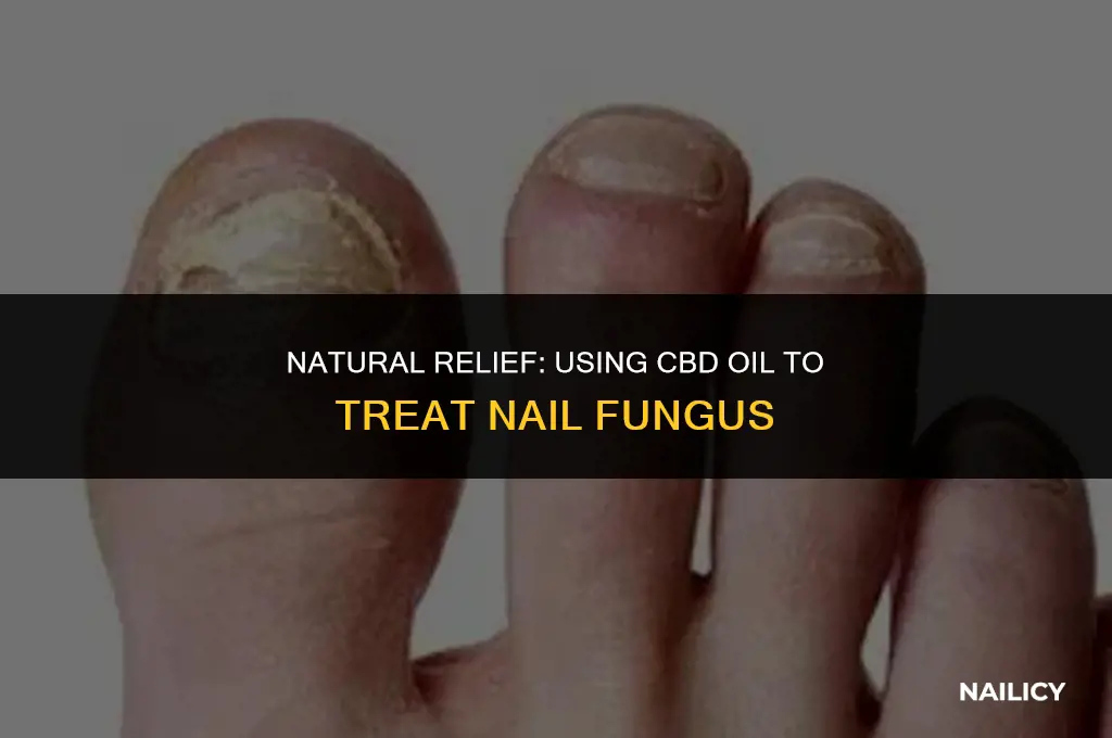 how to use cbd oil for nail fungus
