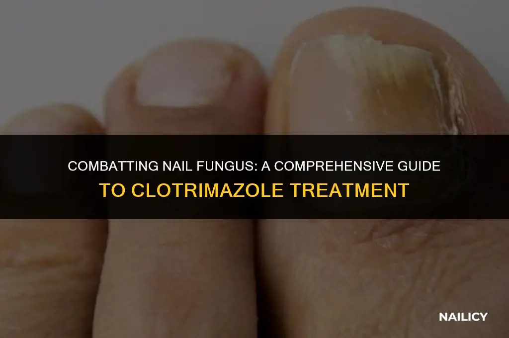 how to use clotrimazole for nail fungus