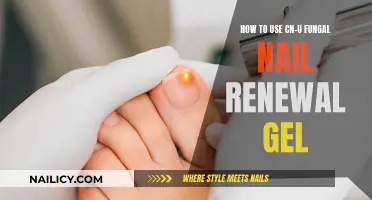 Effective Nail Care: Using CN-U Fungal Nail Renewal Gel