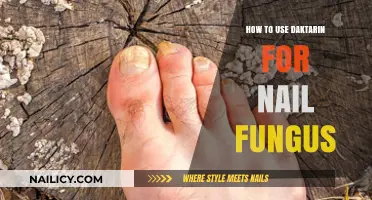 Combatting Nail Fungus: A Comprehensive Guide to Using Daktarin