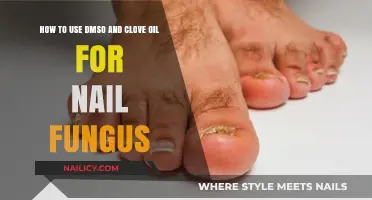 Natural Remedies for Nail Fungus: DMSO and Clove Oil Treatment Guide