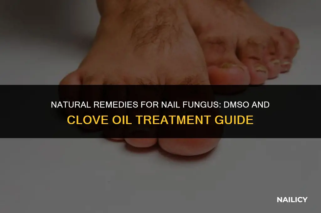 how to use dmso and clove oil for nail fungus
