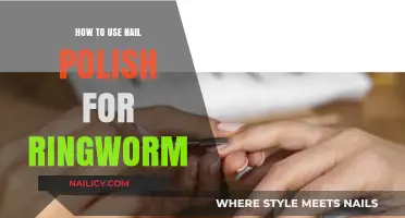 Using Nail Polish for Ringworm: A Surprising Home Remedy Guide