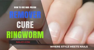 Nail Polish Remover: A Quick Ringworm Cure