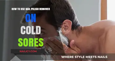 Treating Cold Sores: Nail Polish Remover Application Tips