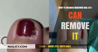 Weakening Ingrown Nails: An Easy, Safe Removal Guide