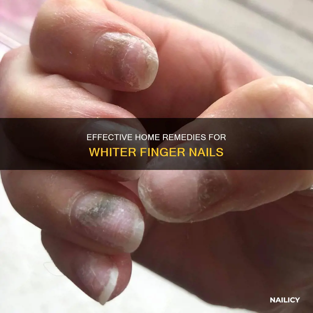how to whiten finger nail