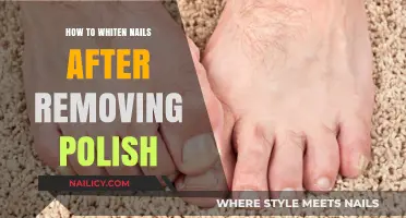 Get Rid of Yellow Nails Post-Polish