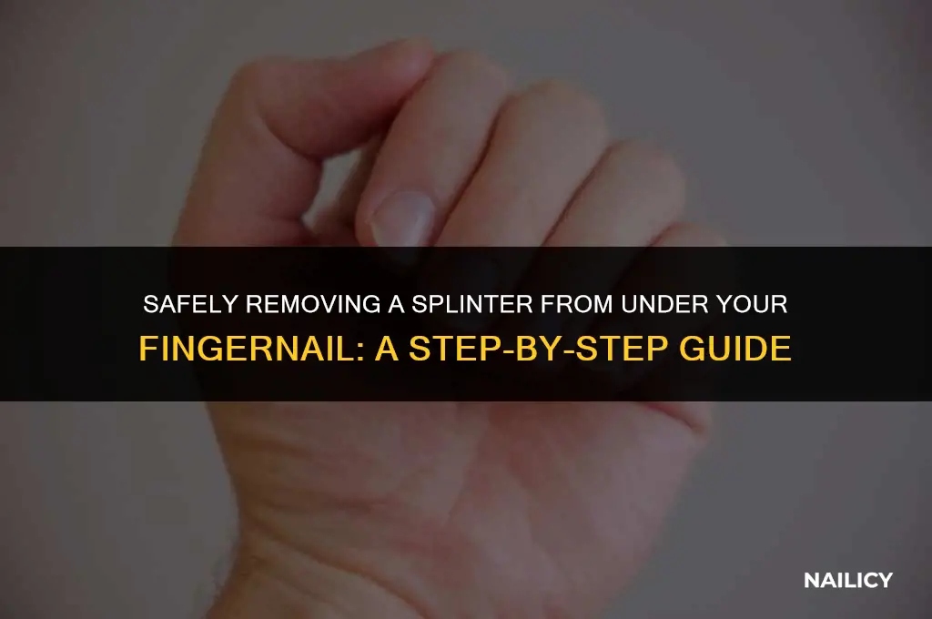 how togetasplinteroutfromunder finer nail