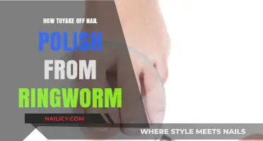 Effective Ways to Remove Nail Polish from Ringworm Safely and Gently