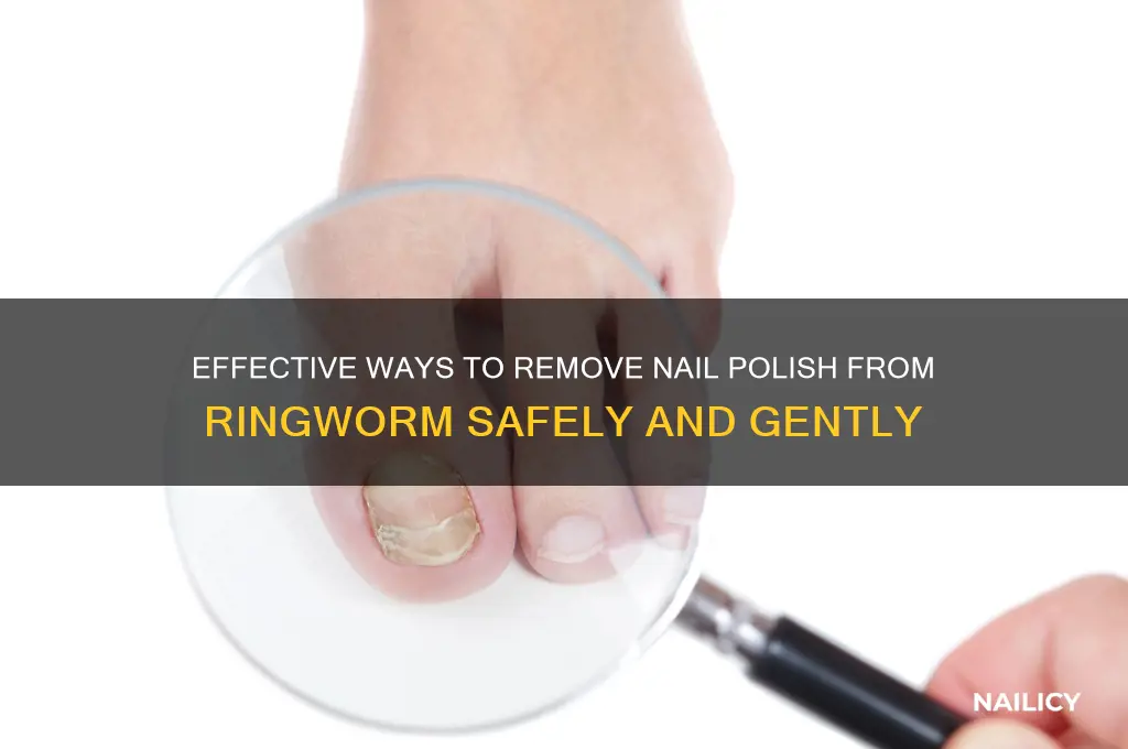 how toyake off nail polish from ringworm