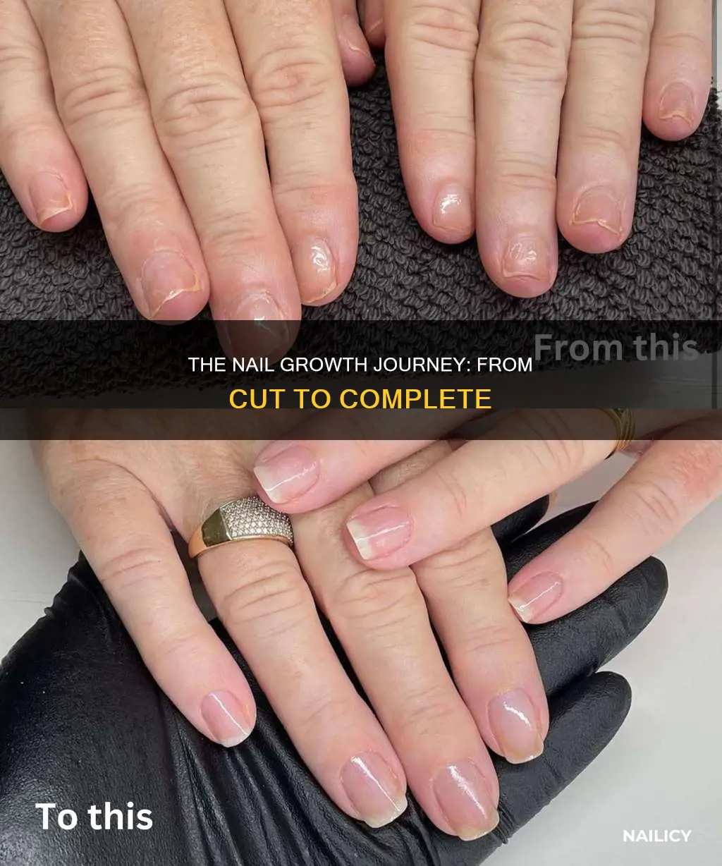 how until a nail grows out