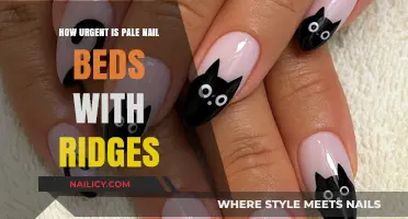 Pale Nail Beds with Ridges: Should You Seek Immediate Medical Attention?