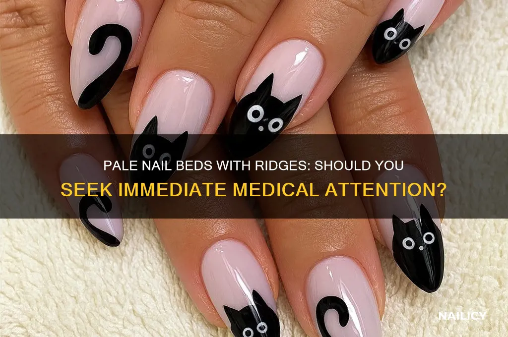 how urgent is pale nail beds with ridges