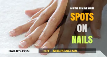 Get Rid of White Spots on Nails