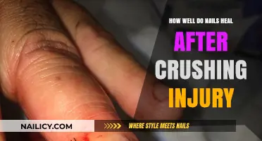 Nail Healing After Crushing Injury: Recovery Process and What to Expect