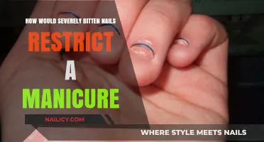 Severely Bitten Nails: Challenges and Limitations for a Perfect Manicure