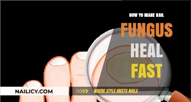 Effective Remedies to Speed Up Nail Fungus Healing Naturally
