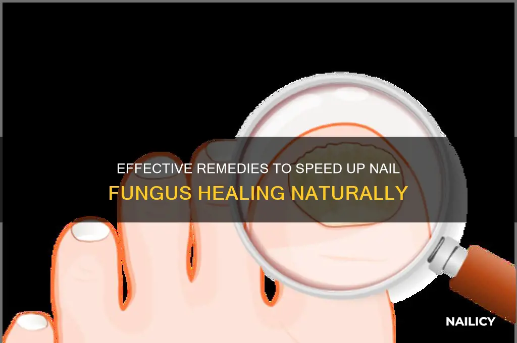 how yo make nail fungus heal fast