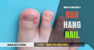Quick Fixes: How to Safely Resolve a Painful Hang Nail