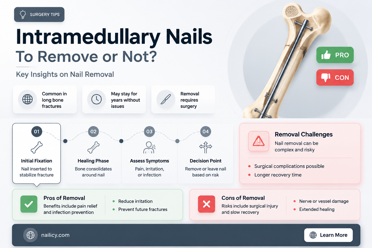 are intramedullary nails removed