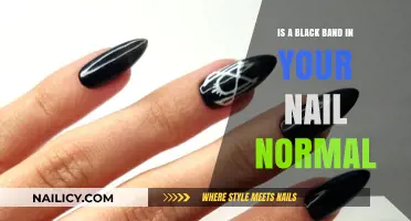 Black Band on Your Nail: Normal or Cause for Concern?