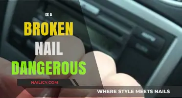 The Hidden Dangers of a Broken Nail: What You Need to Know