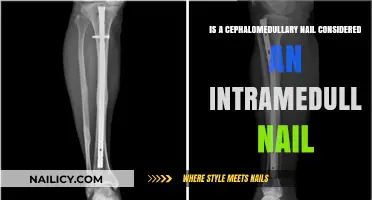 Cephalomedullary Nail: Is It an Intramedullary Nail?