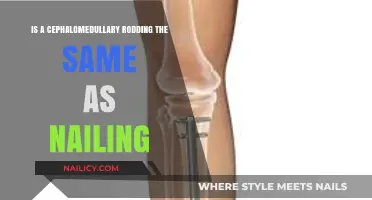 Cephalomedullary Rodding vs. Nailing: Understanding the Key Differences