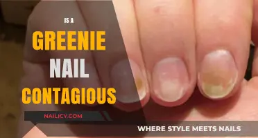 The Truth About Greenie Nails: Causes, Symptoms, and Treatments