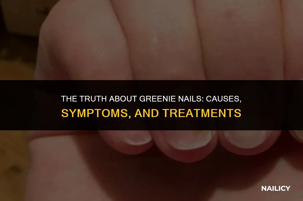 is a greenie nail contagious
