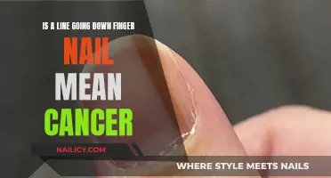 Nail Line: A Cause for Concern? Unraveling the Cancer Mystery