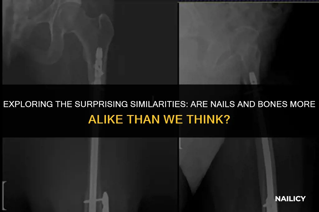 is a nail a bone