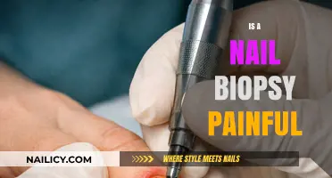 Understanding Nail Biopsy: What to Expect and Is It Painful?