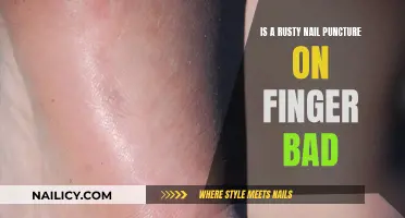 Rusty Nail Puncture: What You Need to Know