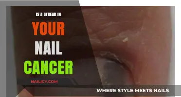 Nail Streak: Harmless Line or Potential Cancer Sign?