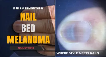 Nail Pigmentation: Melanoma or Harmless? Understanding Nail Bed Changes