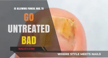 Untreated Fungal Nail Infections: Risks, Complications, and Why You Should Act