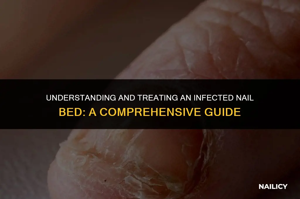 is an infected nail bed