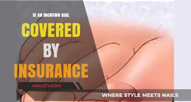 Is Ingrown Nail Treatment Covered by Insurance? What You Need to Know