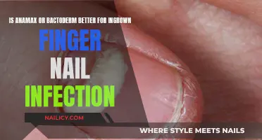 Anamax vs Bactoderm: Which Treats Ingrown Nails Better?