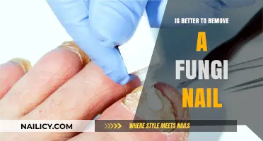 Removing Fungi Nails: Is It Worth the Fuss?