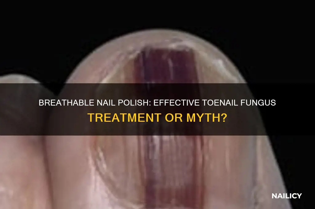is breathable nail polish good for toenail fungus